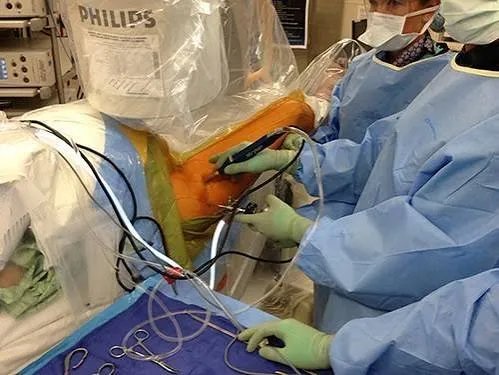 Artroscopia de cadera: choque femoroacetabular y lesiones del labrum