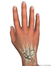 Rizartrosis y artroscopia trapeciometacarpiana: indicaciones emergentes 2026