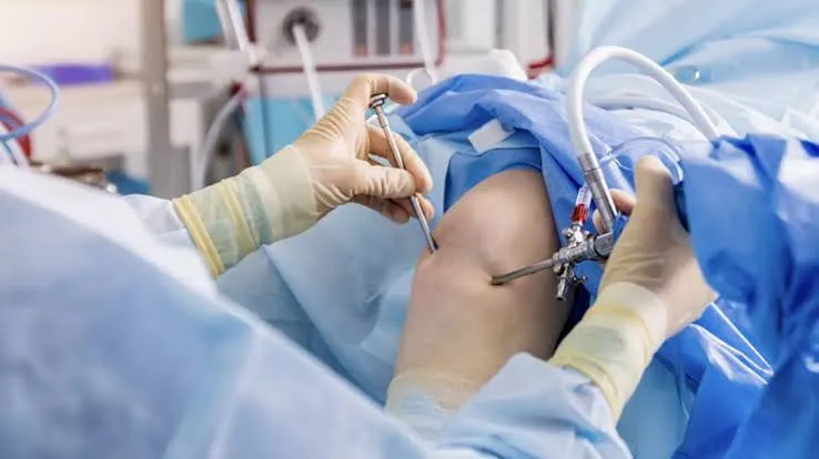 Artroscopia en la rodilla artrósica: qué dice la evidencia sobre cuándo no operar