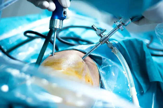 Terapias del cartílago en rodilla: condrocitos, membranas y células con evidencia