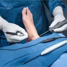 Portales del tobillo y nervio peroneo superficial: anatomía de seguridad